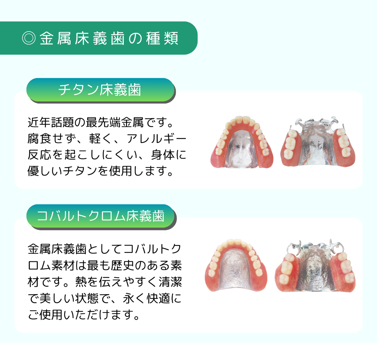 金属床義歯の種類
